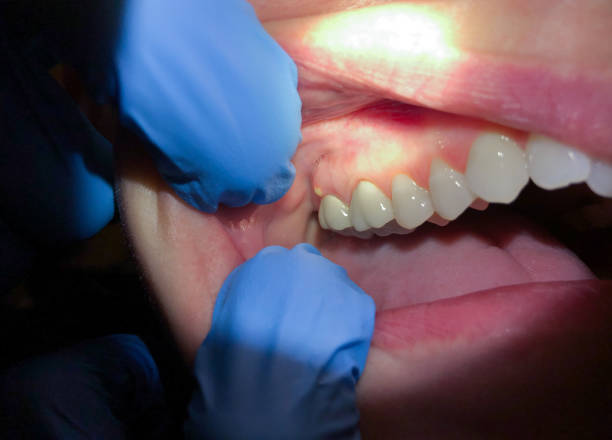 Best Weekend Emergency Dentist in Winnsboro Mills, SC